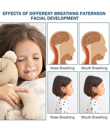 180Pcs Sleep Strips Mouth Tape for Mouth Breathing Prevention - Buy Online on GoSupps.com