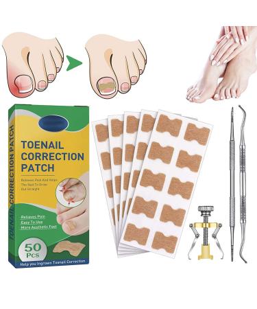 Treatment Ingrown Toenail Corrector Strips,Fitmedify Nail Patches with Nail Correction Tool Kit,Toenail Correction Patch,Ingrown Toenail Removal Kit