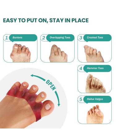 Welnove 8-Pack Toe Separator to Correct Bunions and Restore Toes to Their Original Shape Bunion Corrector for Women Men Toe Spacers for Gifts (Deep Red) - Buy Online on GoSupps.com