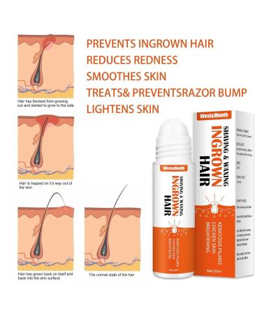 ApexFwdt Re ACT Exalted Minoxi Roll-On Hair Treatment Serum - Natural Nourishing Scalp Oil for Hair Growth and Repair - Women & Men - Buy Online on GoSupps.com