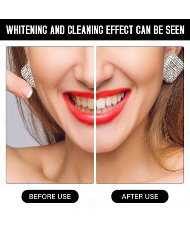 Teeth Whitening 4Pcs Teeth Whitening Kit Mouth Trays Resuable Gum Shield for Whitening Teeth Grinding Guard Suitable for Bruxism Athletes Tooth Whitening and So on - Buy Online on GoSupps.com