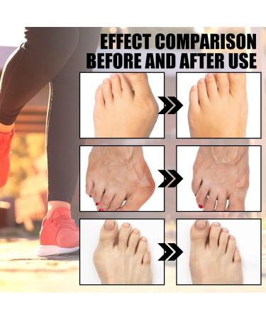 ERGOic Bunion Relief Socks - Anti-Bunion Health Socks for Women and Men - Bunion Corrector Toe Align Socks (Black 5 Pairs) - Buy Online on GoSupps.com