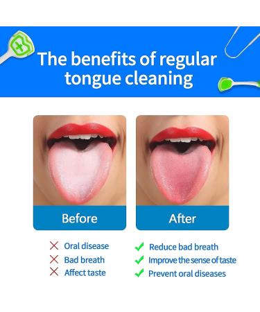 Xrmai 3PCS Stainless Steel Tongue Scraper Set - Tongue Cleaners (3 PCS) - Buy Online on GoSupps.com