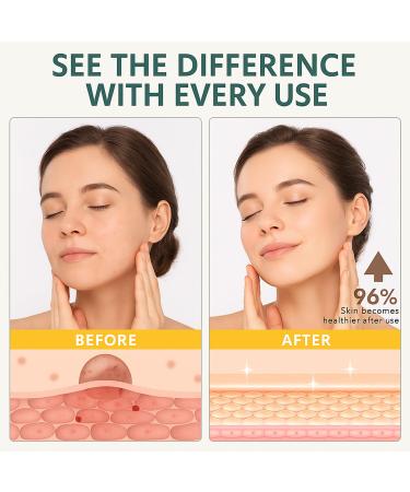 Grass-Fed Tallow Balm with Honey & Beeswax Deep Moisturizing Face & Body Cream Non-Comedogenic Fragrance-Free For Dry Sensitive Skin Calms Redness 4.2 oz 1PCS - Buy Online on GoSupps.com