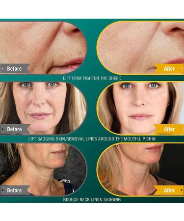 Portable Handheld RF Radio Frequency Machine for Anti-Aging Skin Care - Stylish Multi Device for Face, Neck, Arms, Waist, Buttocks, and Legs - Buy Online on GoSupps.com