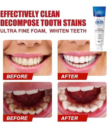 SP-4 Rapid Whitening Toothpaste - Ultra Whitening & Fresh Breath | 100g - 2024 New Formula - Buy Online on GoSupps.com