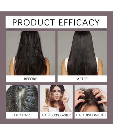  homomdy Hair Growth Shampoo with Onions and Rosemary Nourishing Shampoo for Thinning Hair for Men and Women Anti-Hair Loss Cleanses and Moisturizes Improves Frizz 2 - Buy Online on GoSupps.com