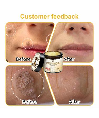 2024 Bee Venom Skin Treatment Cream | Deep Nourishment & Repair for All Skin Types | Professional Beauty Care for Men & Women - 2 Cans (30ml - Buy Online on GoSupps.com