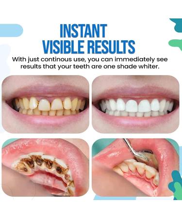 Whiteout Instant Teeth Whitening Paint - Fast & Effective Tooth Color Solution (1 Pack) - Buy Online on GoSupps.com