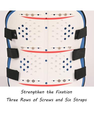Buy SFKLYU Thoracolumbar Fixed Spinal Brace | Adjustable Lumbar Spine Support for Compression Fracture Rehabilitation - International Shipping - Buy Online on GoSupps.com