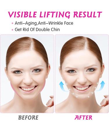 JIEYAO V Line Double Chin Reducer for Women Reusable Lifting Mask with Chin Strap Mask Facial Slimming Strap V-Shaped Slimming Face Mask Face Lifting Belt One Fits All Prevent Sagging(Purple) - Buy Online on GoSupps.com