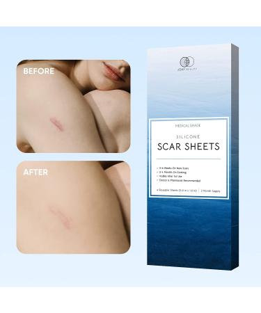 Silicone Scar Removal Sheets - Reusable & Waterproof Patches for C-Section, Burn, Acne, Stretch Marks - 4 Sheets - Buy Online on GoSupps.com