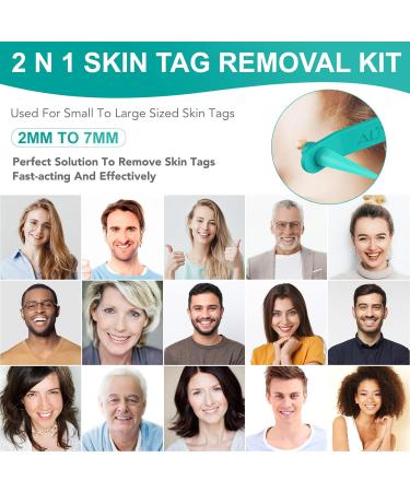 Skin Tag Remover 2 in 1 Kit for Medium/Large Skin Tags - Painless Mole Wart Treatment Tool for Face and Body - Buy Online on GoSupps.com