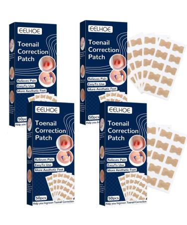 200 Pieces Ingrown Toenails Stickers Toenail Correction Patch Glue-Free Ingrown Curved Toenail Lifter Foot Care Treatment Pedicure Tool (A)