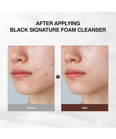 Ottie Black Signature Foam Cleanser 4.05 fl oz | facial cleanser facewash hydrating face wash makeup remover pore cleaner foaming face wash cleanser travel face wash face cleanser for women - Buy Online on GoSupps.com