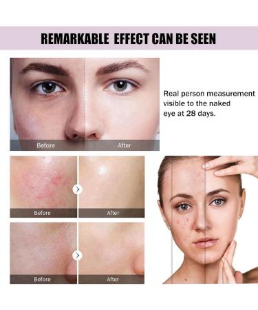 Hyaluronic Acid 2%+B5 Face Serum Hyaluronic Acid Serum for Face Hyaluronic Acid Serum Skincare Moisturiser Face Brightening Serum Face Serum for Women to Smooth Skin Anti Aging Serum for Face - Buy Online on GoSupps.com