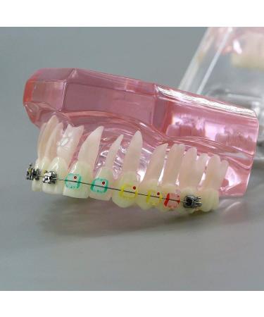 HDGRNCC Dental Orthodontic Brackets Model - Metal Ceramic Self-Ceramic Bracket for Training | International Shipping - Buy Online on GoSupps.com