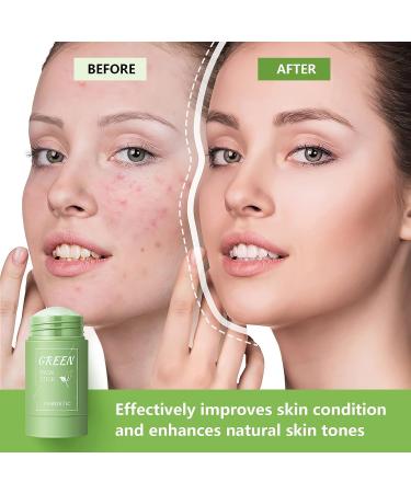 Anguishil Green Tea Mask Stick - Deep Cleanse & Oil Control for All Skin Types (1 PCS) - Buy Online on GoSupps.com