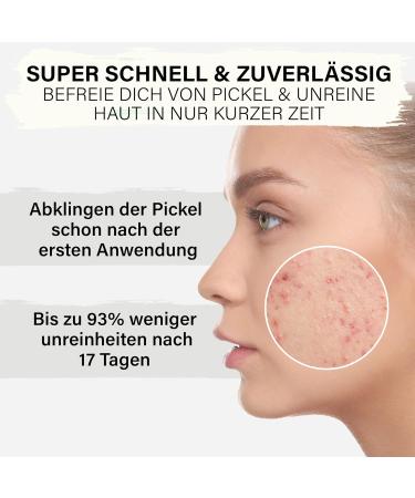 Leafy Zinc Ointment for Pimples | High Dosage with Tea Tree Oil & Salicylic Acid | 50ml Natural Anti-Pimple Cream | Satisa - Buy Online on GoSupps.com