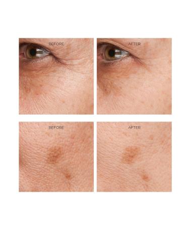 Rejuvenation Serum for Line Lifting & Crow's Feet - Anti-Aging Solution | Shop Internationally - Buy Online on GoSupps.com