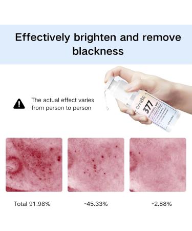 IZBEAUVO Dark Spot Correcting Glow Serum Facial Serum Brightening Essence Dark Spot Correcting Serum Brightening Serum Skin Brightening Cream for Dark Skin Collagen Boost Anti Aging Aerum - Buy Online on GoSupps.com