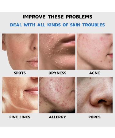 Face Mask Set - Face Masks Skincare - Face Masks Beauty for Hydrating Smoothing Firming - Gift Sets for Women Sale - Sheet Mask Skincare Set - Hydrating Face Mask Skin Care Sets & Kits - Face Care - Buy Online on GoSupps.com