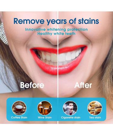 Douceur Teeth Whitening Kit - Professional 32X LED Whitener with 3 Non-Sensitive Gel Pens for Quick and Gentle Smile Whitening - Buy Online on GoSupps.com