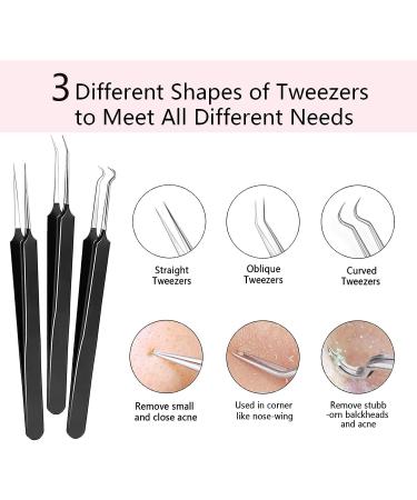 Xesscare 7-Piece Pimple Popper & Blackhead Remover Tool Kit - Acne Extractor & Tweezers for Facial, Nose, and Forehead - Blemish & Whitehead Removal (Black) - Buy Online on GoSupps.com