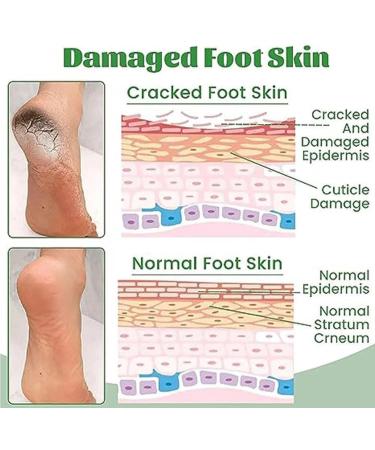 Heel Repair and Moisturizing Cream Rapid Cracked Repair Foot Cream Anti-Cracking Moisturizing Foot Cream Repairs and Moisturizes Dry Feet Fast Absorbing - Buy Online on GoSupps.com