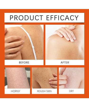  XUSHAOLUN Persimmon Shower Gel for the Elderly Anti-Odor Body Control with Persimmon Extract Eliminates Odors on Thighs and Underarms Long-Lasting Moisturizer (5PCS) - Buy Online on GoSupps.com