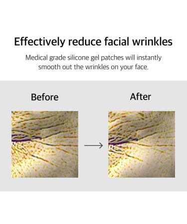 Anti-Wrinkle Silicone Gel Patch - Reusable Facial Smoothing Patches for Eyes Forehead & Neck | International Shipping - Buy Online on GoSupps.com