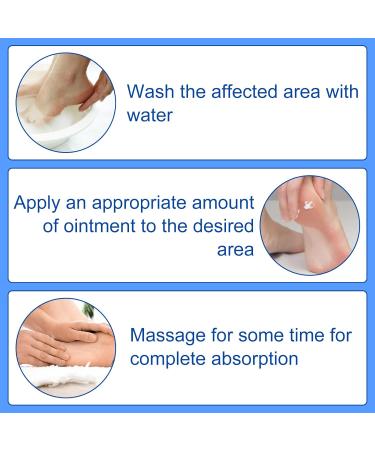 Lot de 2 pommades contre les perons calcan ens - Pommade apaisante pour perons calcan ens - Soulage l'inconfort des pieds 4 - Buy Online on GoSupps.com