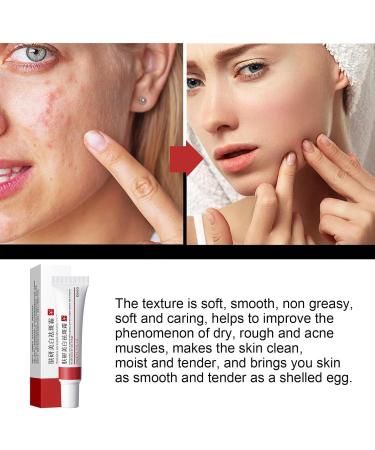 SGHOPLG 3Pcs Effective Whitening Freckle CreamRemove Melasma Acne Cream Fading Spot CreamAcne Scar Removal TreatmentFade Pigmentation Anti Melasma Brighten Skin Care Creams - Buy Online on GoSupps.com