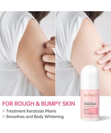 Skin Exfoliating Repair Cream Chicken Skin Care Cream Strawberry Legs Treatment Body Cream - Buy Online on GoSupps.com