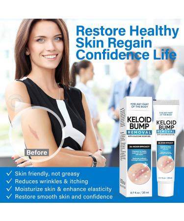 Silicon Scar Gel for Keloid & Piercing Bump Removal - 0.7 Oz - Buy Online on GoSupps.com