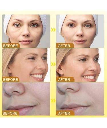  Jesshiny Rekulo 3-Pack Anti-Wrinkle Bee Venom Creams 2026 Skin Care and Anti-Aging Face Cream with 2026 Bee Venom Firming Serum for All Skin Types - Buy Online on GoSupps.com