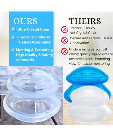 Cupping Warehouse TM Beginner Soft Supreme 2 Large Intermediate Cupping Therapy Set- Beginner Clinic & Home Use Silicone Cupping Set Suction Cups for Body - IP5560 - 2 Large - Buy Online on GoSupps.com