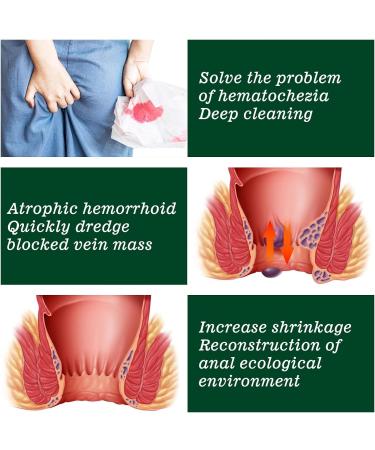 Heca Natural Herbal Hemorrhoid Relief Capsules - Fast Relief for Hemorrhoids and Anal Fissures - Buy Online on GoSupps.com