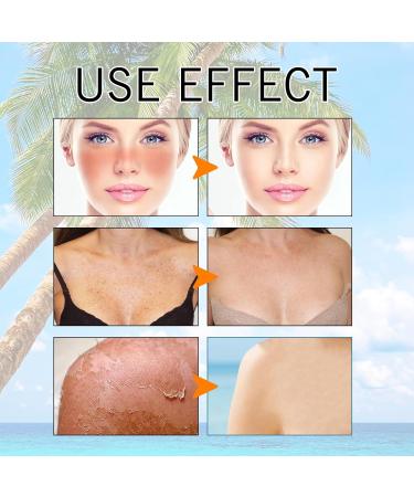 Hyaluronic Acid Watery Sun Gel - SPF50+ PA++++ Sunscreen Hyaluronic Acid Sunscreen Daily Moisturizing Sunscreen Sunscreen Face Moisturiser With No White Cast (50ML) - Buy Online on GoSupps.com