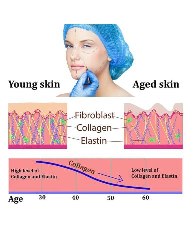 Oldream PDO Threads for Face Lift - Mono Screw Type - 30G 25MM - 20pcs | International Shipping Available - Buy Online on GoSupps.com