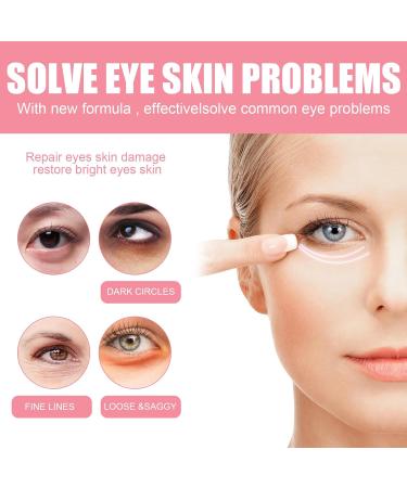 LinBomZony Rosehip Balm Moisturizing Under Eye Treatment to Improve Dark Circles Around Eyes Smooth Wrinkles Nourishing Formulated Rosehip Oil for Smooth 1 Piece - Buy Online on GoSupps.com