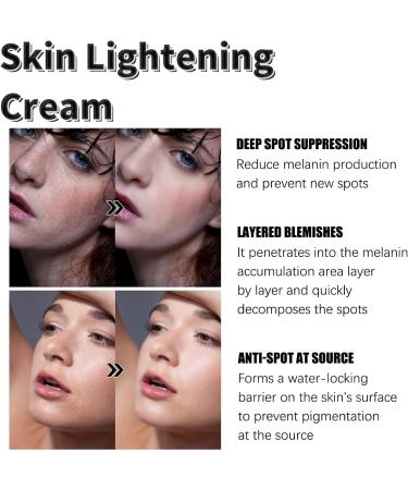 Fade Stain Beauty Cream Freckle Remover Cream Dark Spot Remover for Face Dark Spot Correcting Glow Serum Dark Spots Remover Dark Spot Corrector Cream Age Spot Remover Dark Spot Cream Spot Remover - Buy Online on GoSupps.com