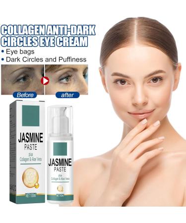 SEGMINISMART Jasmine Cream for Dark Circles Slip-On Eyelids Active Jasmine Ointment Jasmine Ointment Dark Circles 100 ml Jasmine Ointment for Dark Circles Makes Wrinkles and Dark Circles Disappear - Buy Online on GoSupps.com
