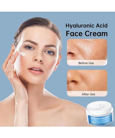 MIZEEYE Hyaluronic Acid Moisturizer For Face, 3.52 oz / 100ML Hyaluronic Acid Cream For Dry & Sensitive Skin, Moisturizing Face Cream For Daily. - Buy Online on GoSupps.com