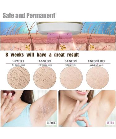 IPL Hair Removal Device - Portable & Compact for Face Legs Armpits & Bikini Area - Best eCommerce Solution - Buy Online on GoSupps.com