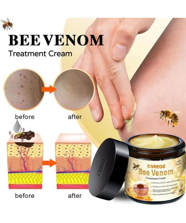 AAFQ Bee Venom Skin Treatment Cream Bee Venom Comprehensive Cream Bee Venom Cream Professional Bee Venom Repair Cream Bee Venom Skin Care for Men&Women (4) - Buy Online on GoSupps.com
