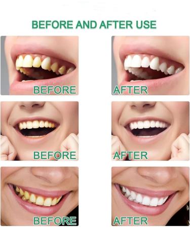  JIAOY Niacinamide whitening toothpaste niacinamide toothpaste gel gentle natural stain-removing toothpaste deep cleaning dazzling whitening toothpaste (4PCS) - Buy Online on GoSupps.com