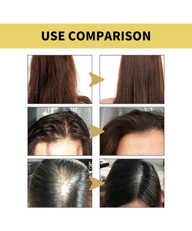 Shantou Yingji 2 pieces ginger shampoo Ginger Hair Regrowth Shampoo ginger itch relieving care shampoo hair strengthening shampoo fluffy nourishing shampoo 2 pieces x 100 ml hair2 pieces - Buy Online on GoSupps.com