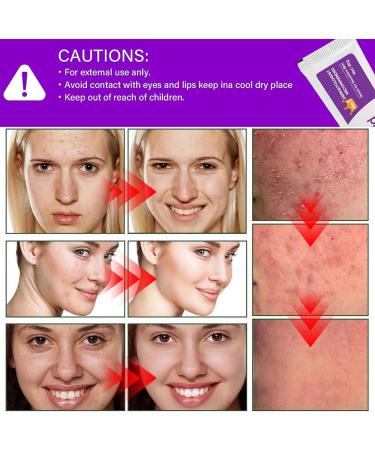 Azelaic Acid 12% Facial Serum Azelaic Acid Serum Face Cream Skin Care Beauty with Niacinamide & Vitamin C Removes Acne Redness Fade Dark Spots Correcting 20G (1) - Buy Online on GoSupps.com