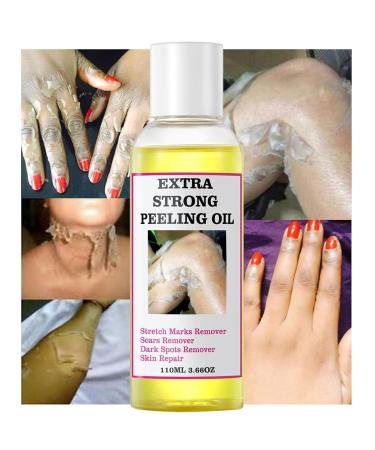 Extra Strong Yellow Peeling Oil | Exfoliating Solution for Body Hands Feet & Face | All Skin Types - 110ML - Buy Online on GoSupps.com